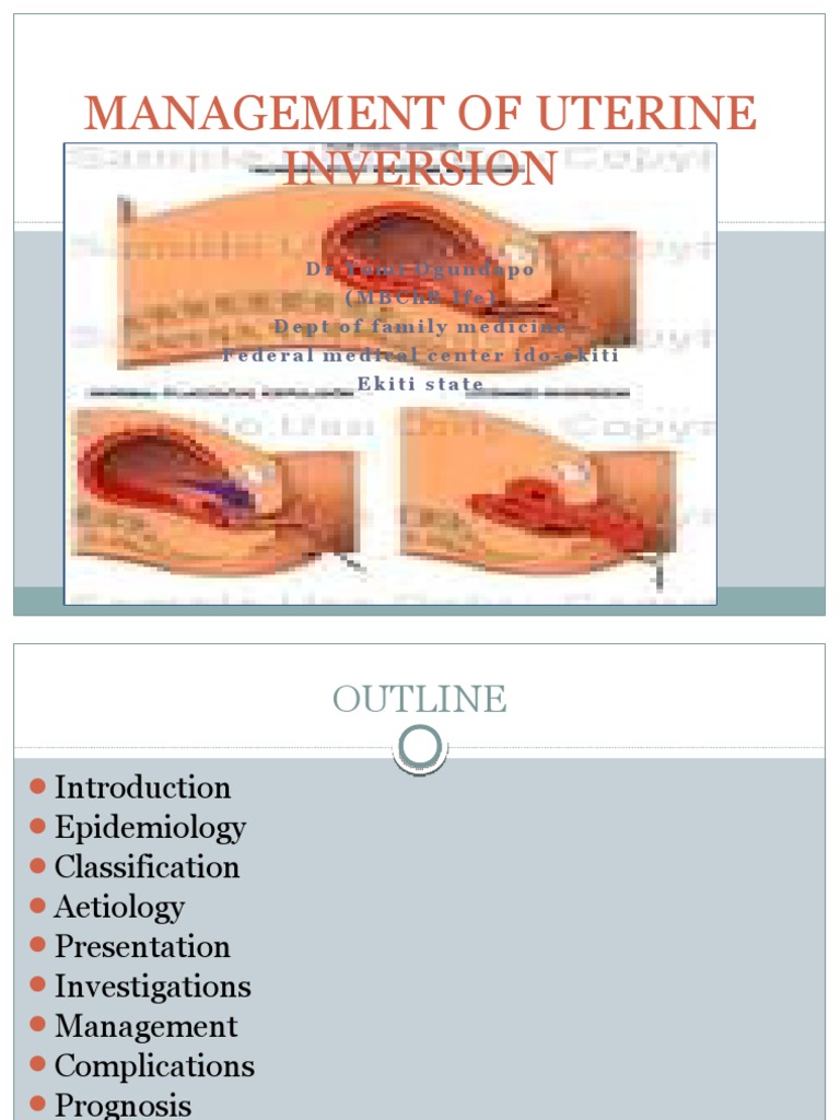 Management of Uterine Inversion Uterus Childbirth