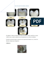 Árbol para El Diagnostico de Esmalte y Dentina