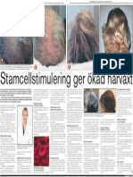 Stamcellstimulering Mot Håravfall