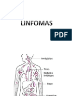 Linfomas de Celulas B Grandes Difusas