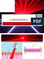 Laser