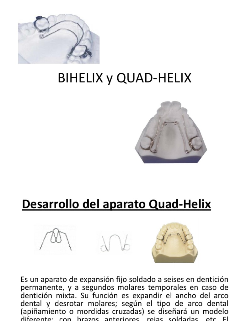 Uso y Funciones del Quad-Helix y Bi-Helix | PDF | Diente humano | Ramas de  Odontología
