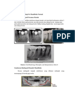 Gambaran Radiologi Os Mandibula Normal New