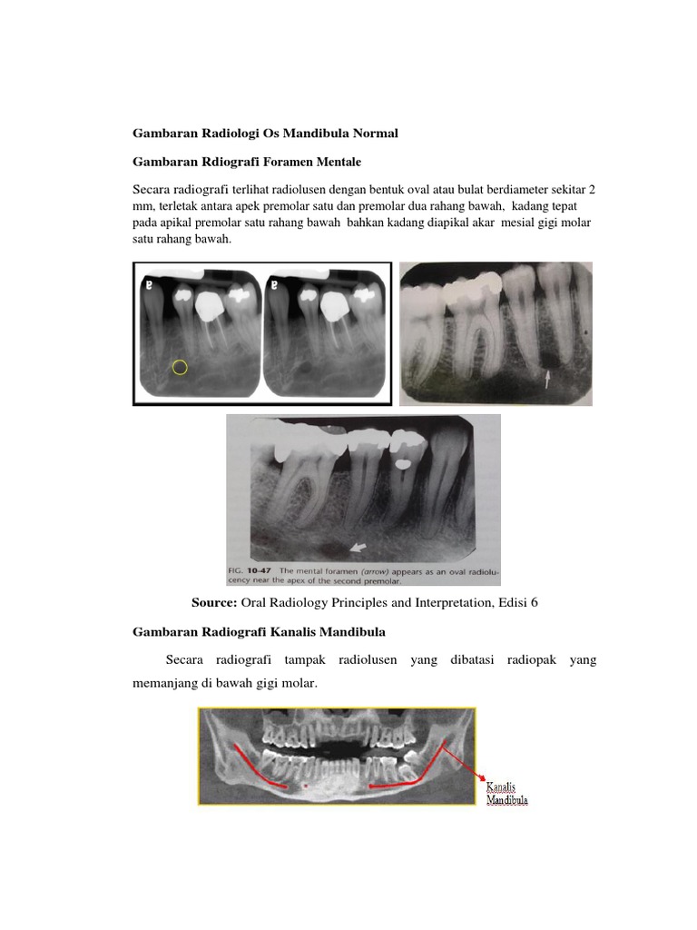 Gambaran Radiografi Os Mandibula Normal | PDF