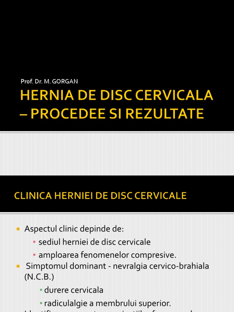 DVC PDF | PDF