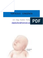 Torticolis Congénita Unfv PDF