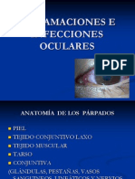 Inflamaciones e Infecciones Oculares