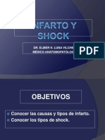 Infarto y Shock