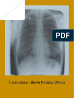 Dossier Tuberculose