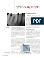 Determining: Working Length