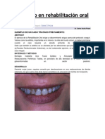 Protocolo en Rehabilitación Oral Integral Dr. Acuña PDF