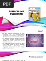 Tuberculose Pulmonar.pptx