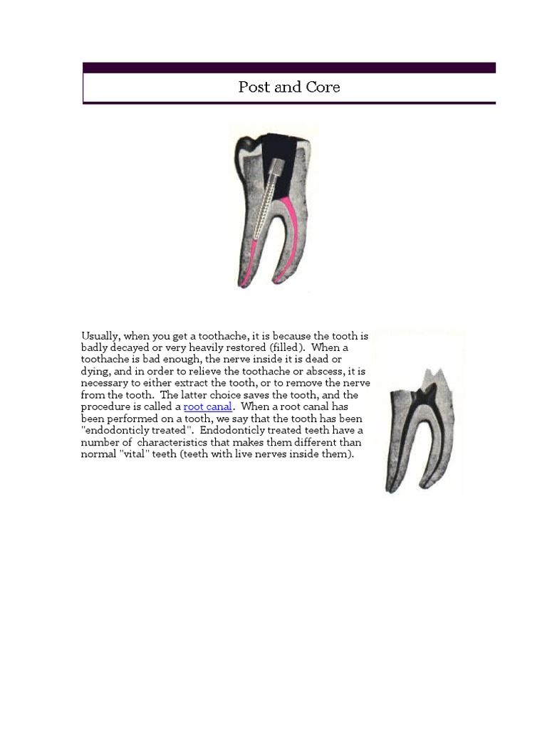 Post and Core Dentistry Branches Medicine