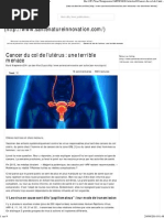 Cancer Du Col de L'utérus - Une Terrible Menace PDF