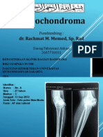 Osteochondroma