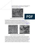 Para El Caso de Los Análisis Microfractográficos