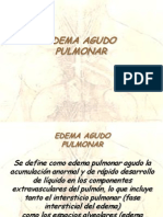 edema-agudo-pulmon (1).ppt