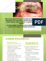 Histoplasmosis