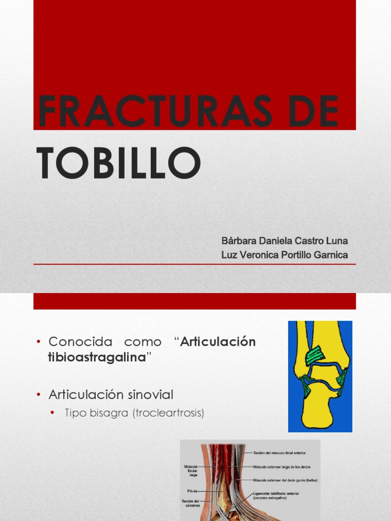 Fracturas de Tobillo | PDF | Tobillo | Extremidades (anatomía)