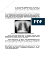 DISKUSI RADIOLOGI Hydropneumothorax