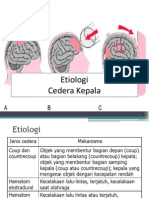Etiologi Cedera Kepala