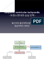 Idiopathic VT 