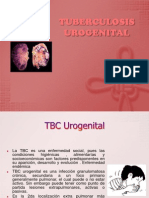 Tuberculosis Urogenital