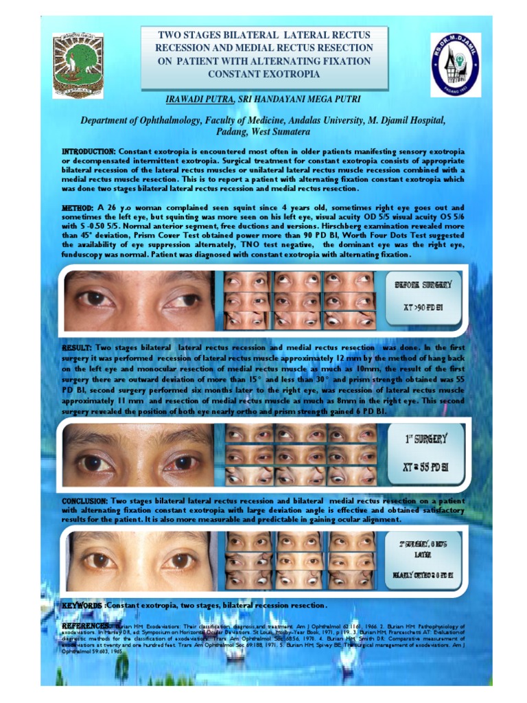 Strabismus Pdf Ophthalmology Clinical Medicine