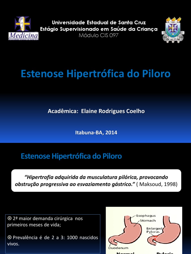 ESTENOSE HIPERTRÓFICA DO PILORO: UMA ABORDAGEM CLÍNICA E RADIOLÓGICA