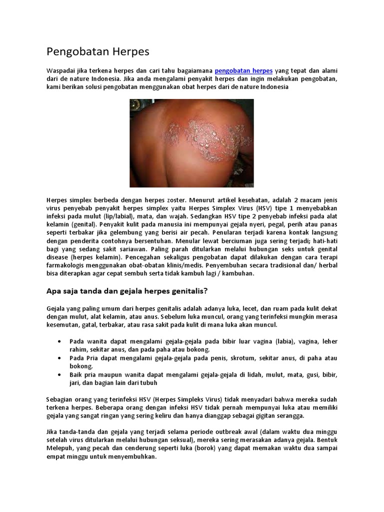 Pengobatan Herpes