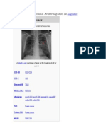Lung Cancer: This Article Is About Lung Carcinomas. For Other Lung Tumors, See