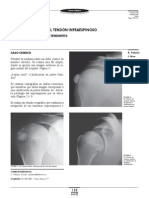 Caso Clin Infraespinoso 159 100