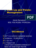Cleft Lip and Palate - Management