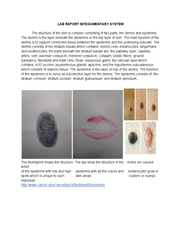 Lab Report Integumentary System | PDF | Skin | Epidermis
