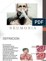 Neumonia