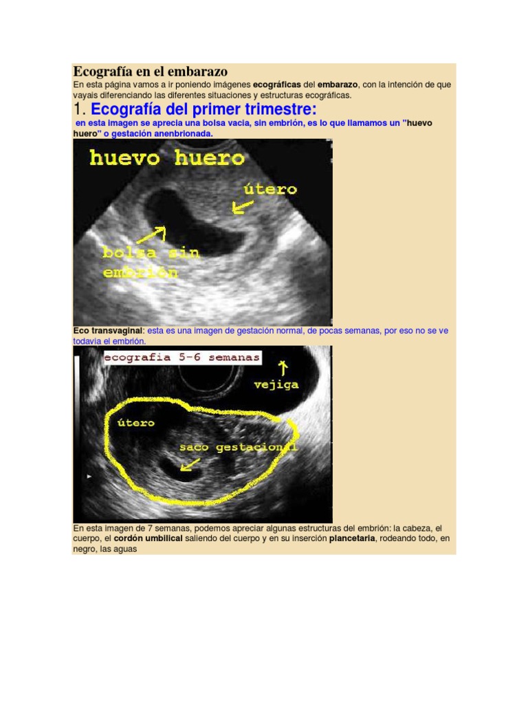 Ecografia del primer trimestre pdf sale