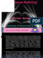 Referat Radiologi Multiple Myeloma DR - Pherena Amalila, SP - Rad