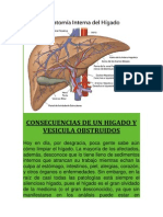 Higado y Vesicula Congestionado de Calculos - Consecuencias de Salud PDF