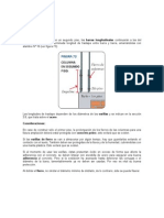 Arranques en Columnas en Pisos Superiores