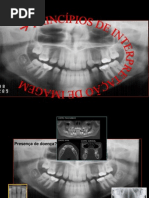 Princípios de Interpretação Radiográfica Abo 2014