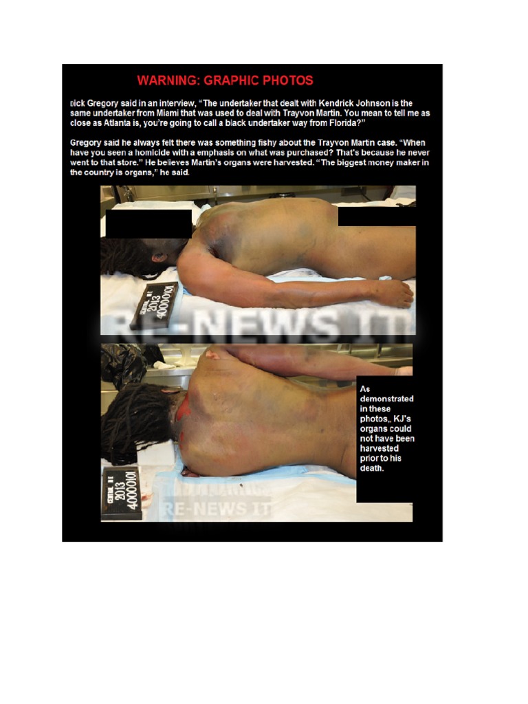 Myth Busters Kendrick Johnson Organs Harvested