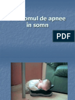 Sindromul de Apnee in Somn