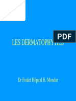 Dermatophyties