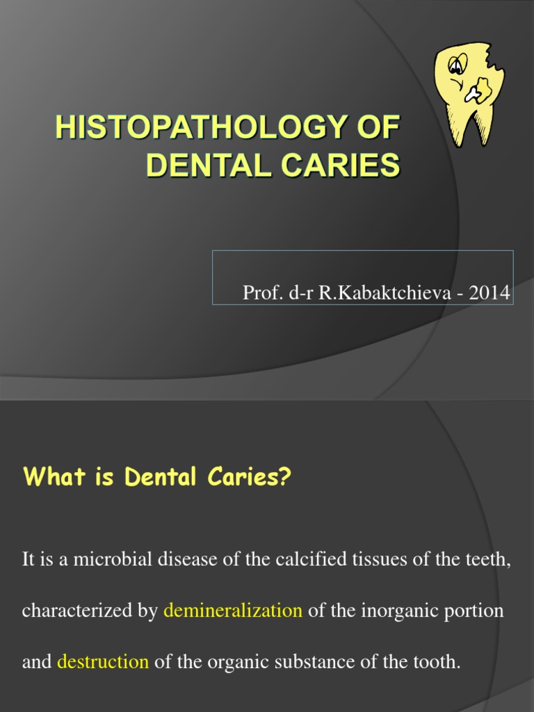 Histopathology of Dental Caries | PDF | Tooth Enamel | Human Tooth