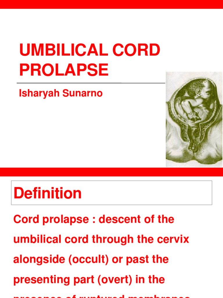 Umbilical Cord Prolapse Fetus Human Diseases And Disorders
