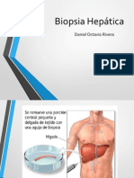 Biopsia Heptica