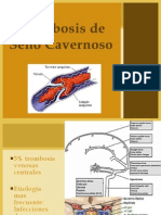 Trombosis Seno Cavernoso