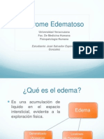 Sindrome Edematoso