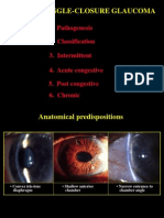 Primary Angle-Closure Glaucoma Types and Treatment