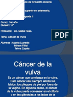 Cancer de Vulva